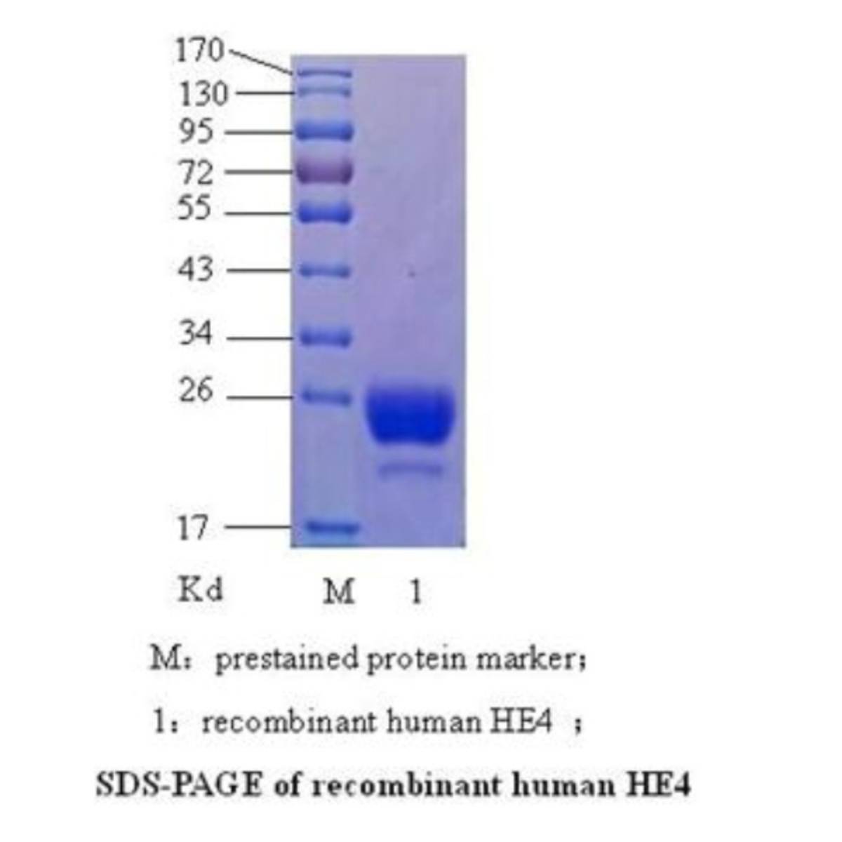 Human Epididymis Protein 4（HE4）Fc tag