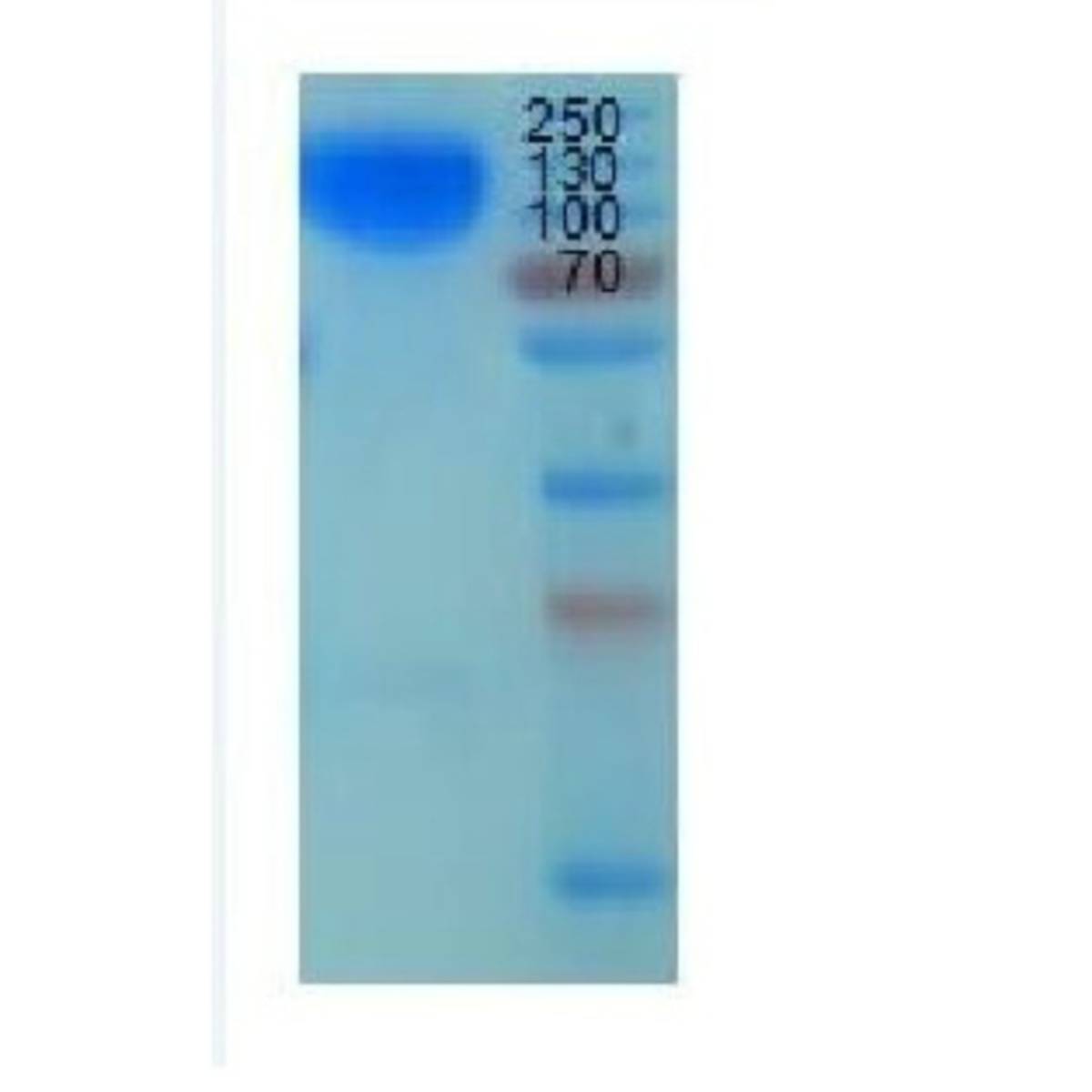 Carcinoembryonic Antigen(CEA)
