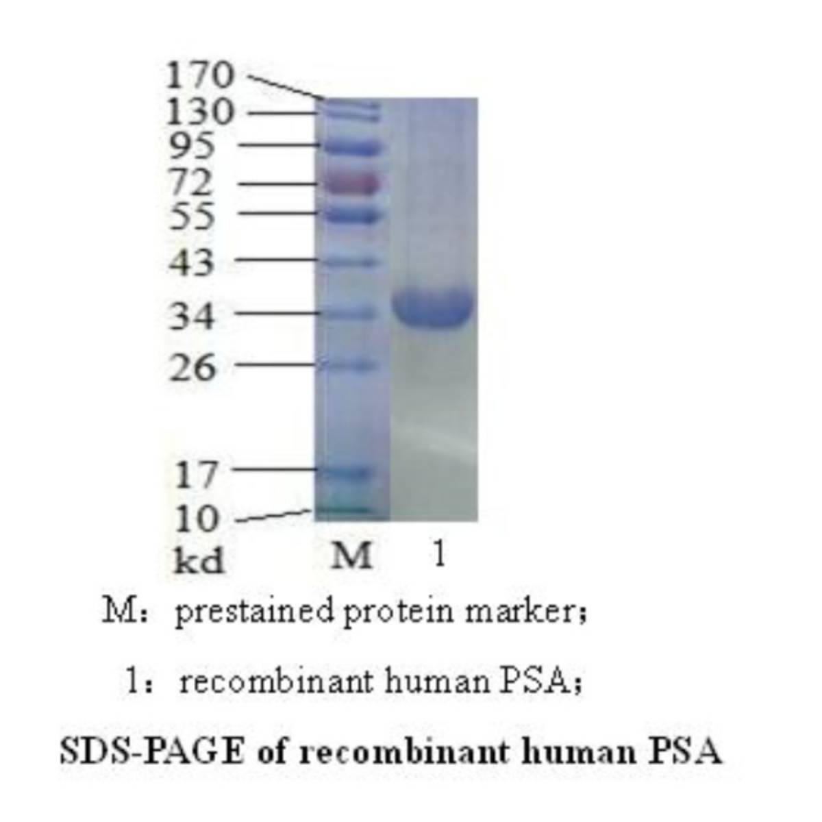 Prostate-Specific Antigen(PSA)