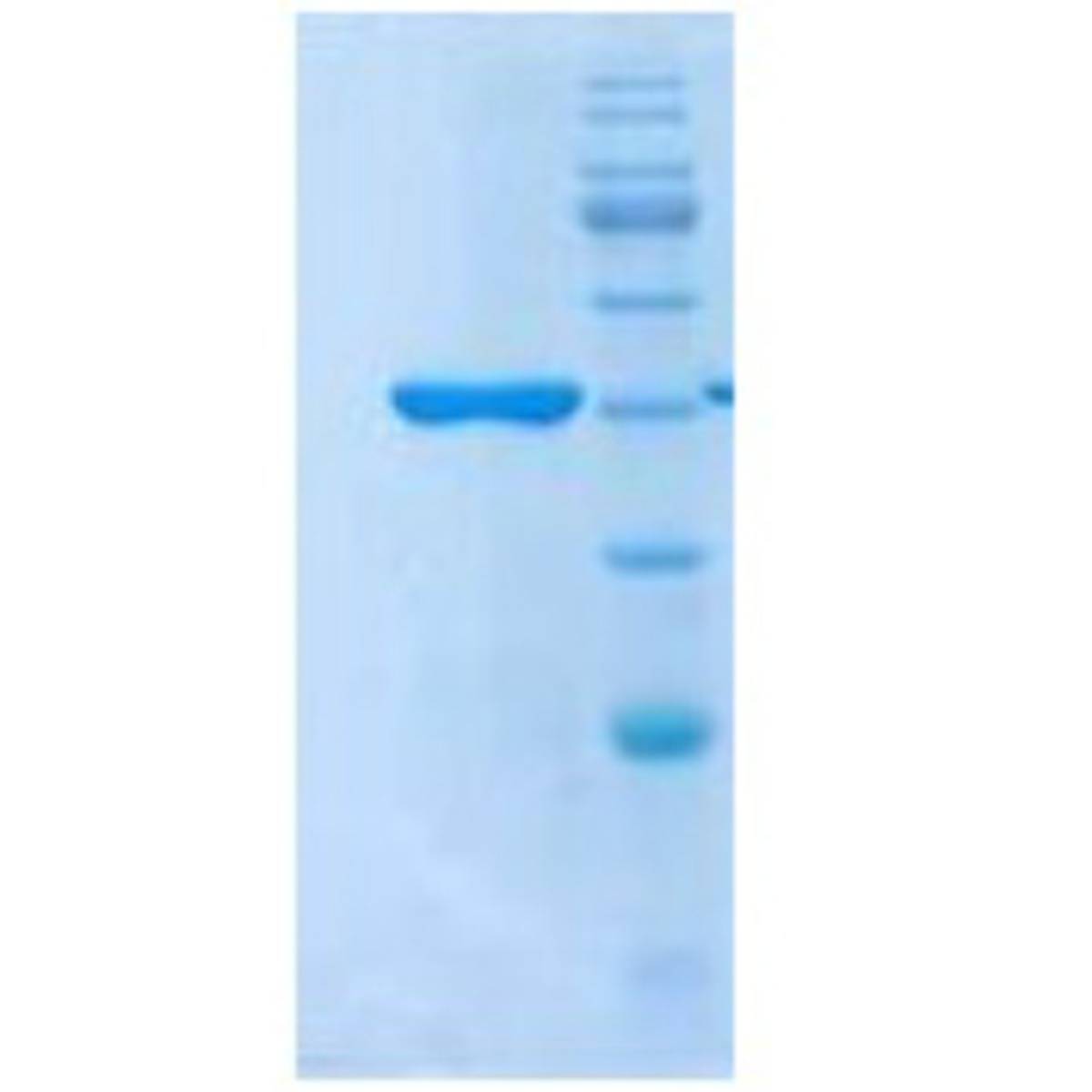 2019-nCoV N Protein