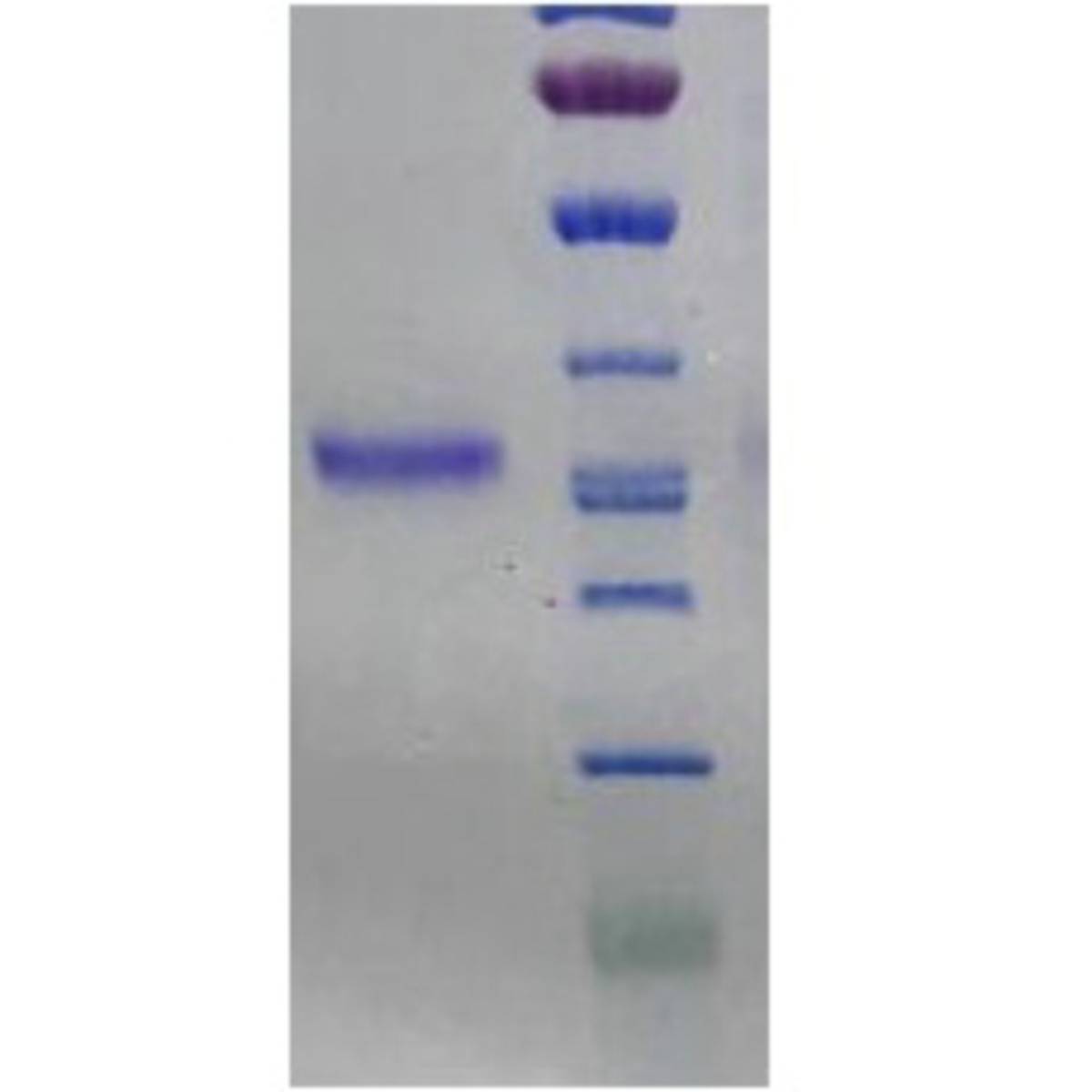 2019-nCoVReceptor Binding Domain(S-RBD His/Fc)