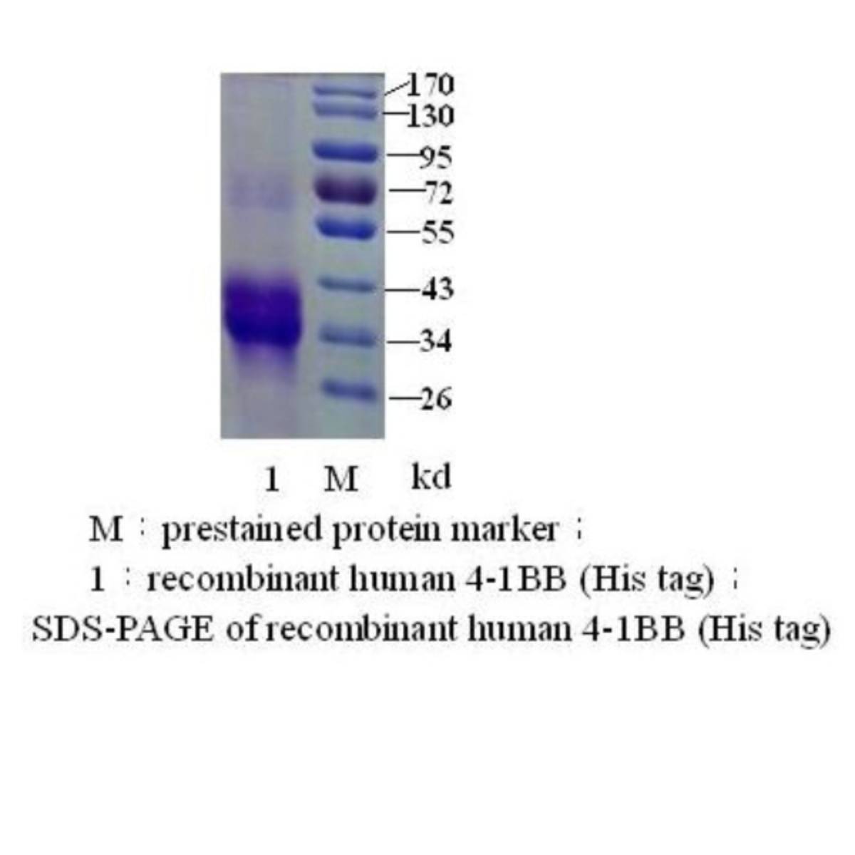 Receptor induced by lymphocyte activation(ILA)4-1BB his/Fc tag