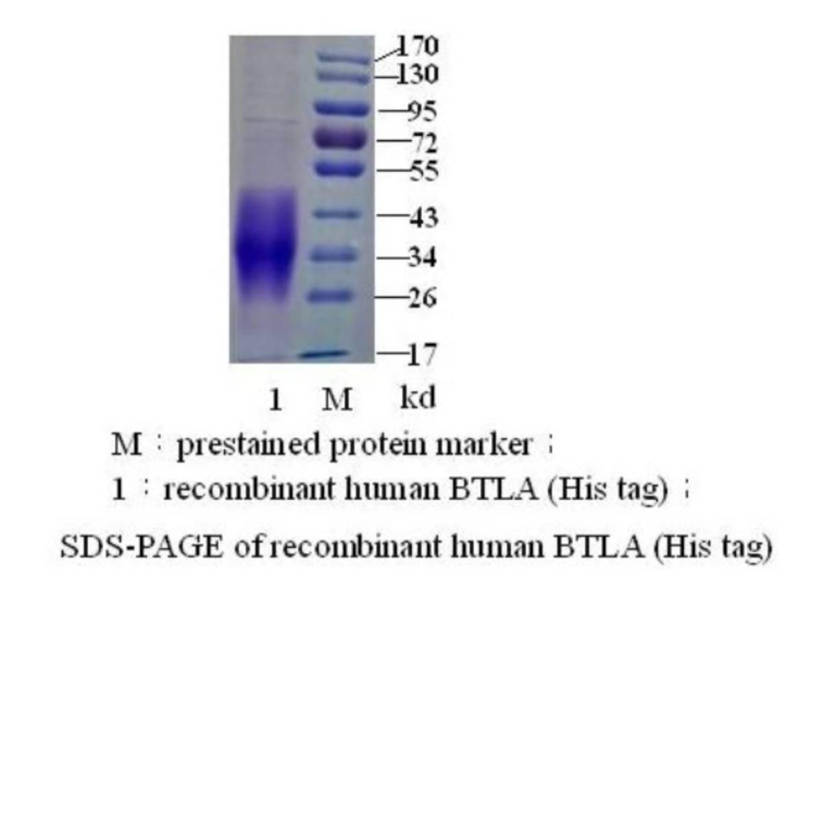 B- and T-lymphocyte attenuator （BTLA）