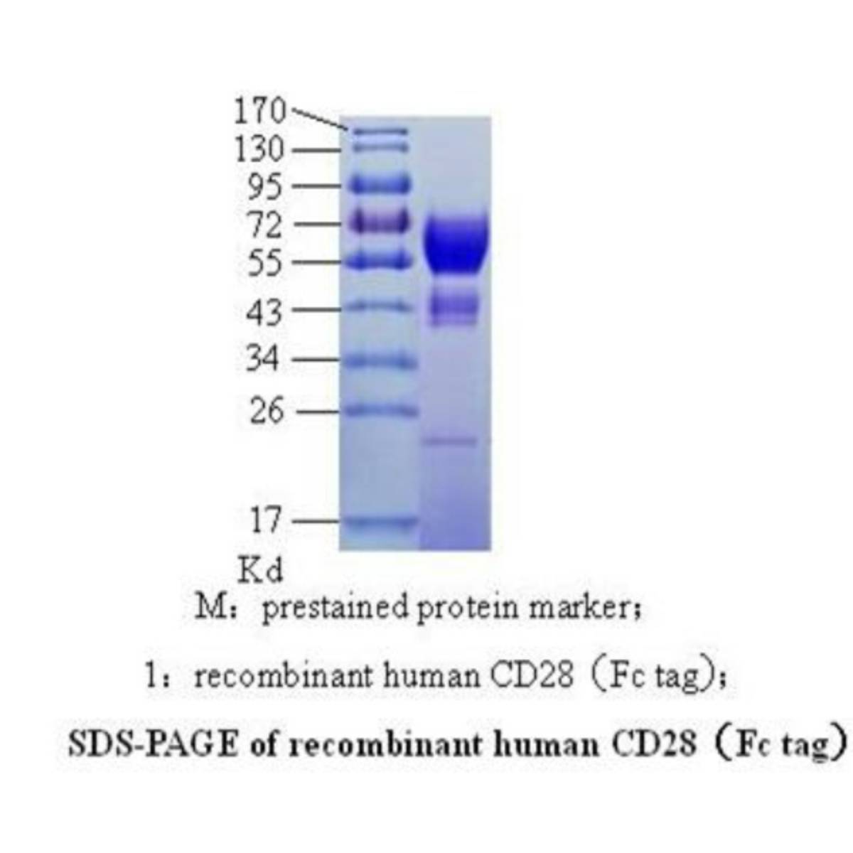 Cluster of Differentiation 28(CD28)