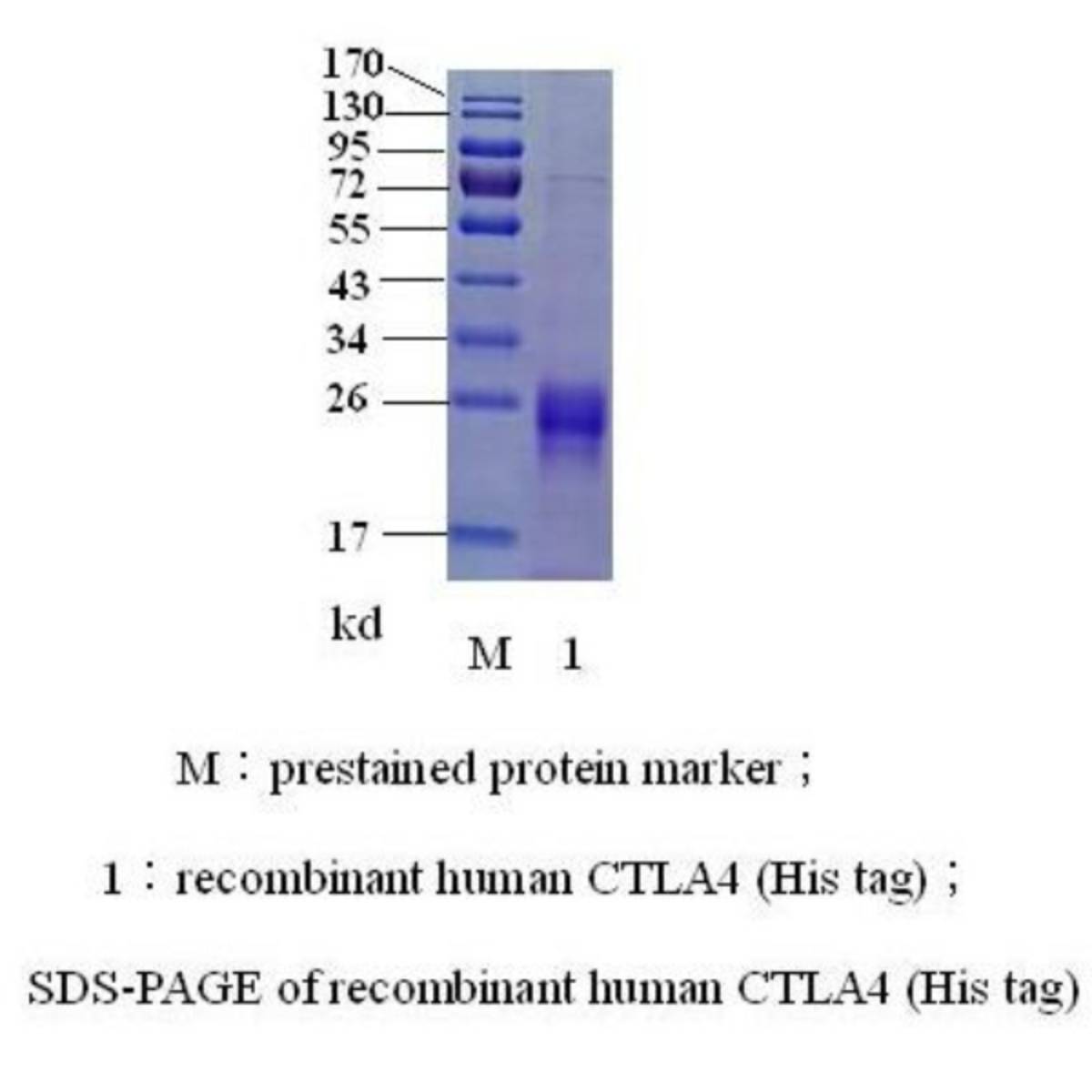 Cytotoxic T lymphocyte-associated antigen-4(CTLA-4)