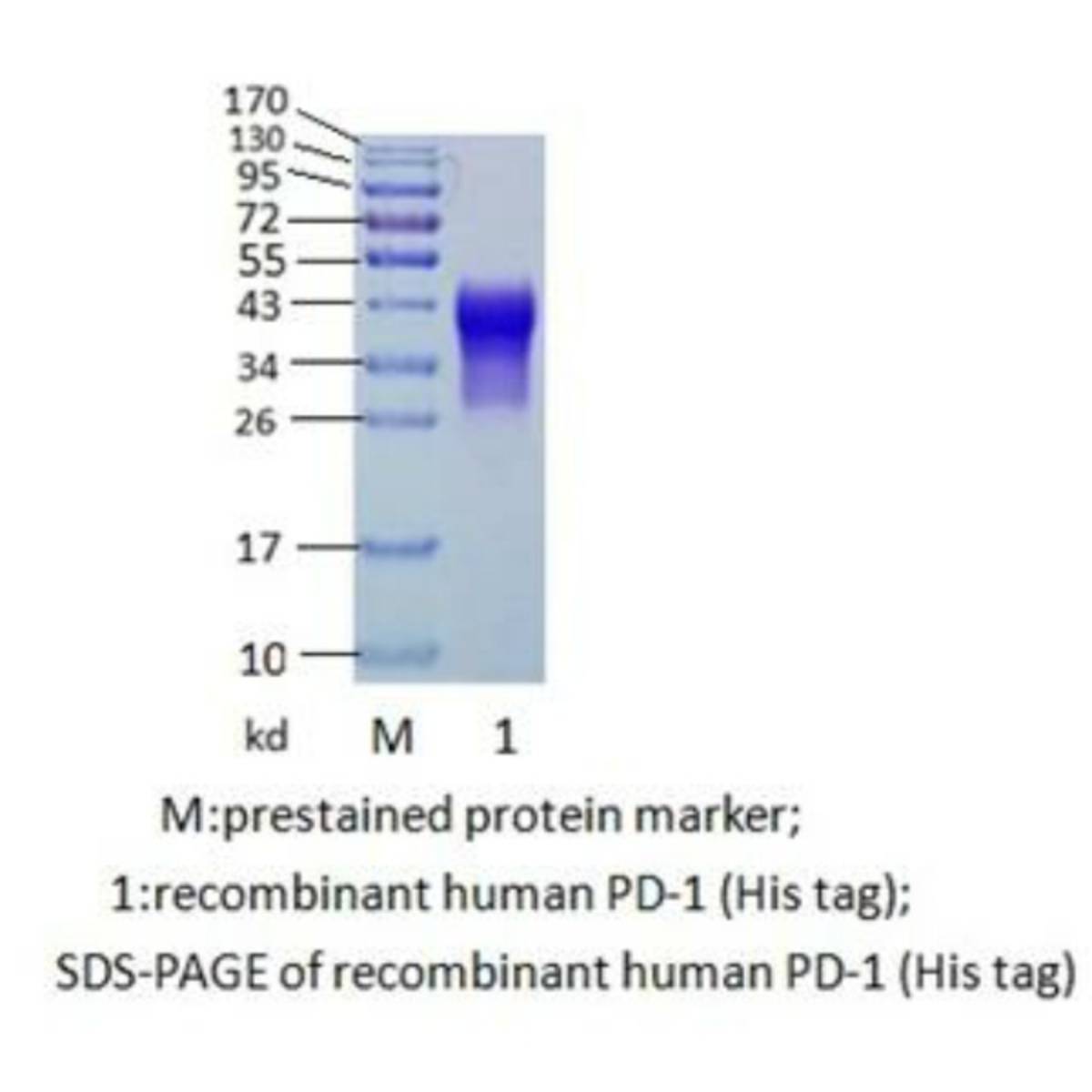 Human PD-1（Programmed Cell Death Protein 1）