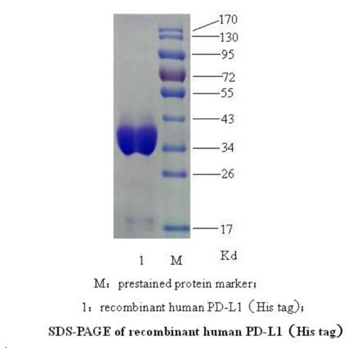 Human PD-L1 (programmeddeath-1 ligand,B7-H1,CD274)