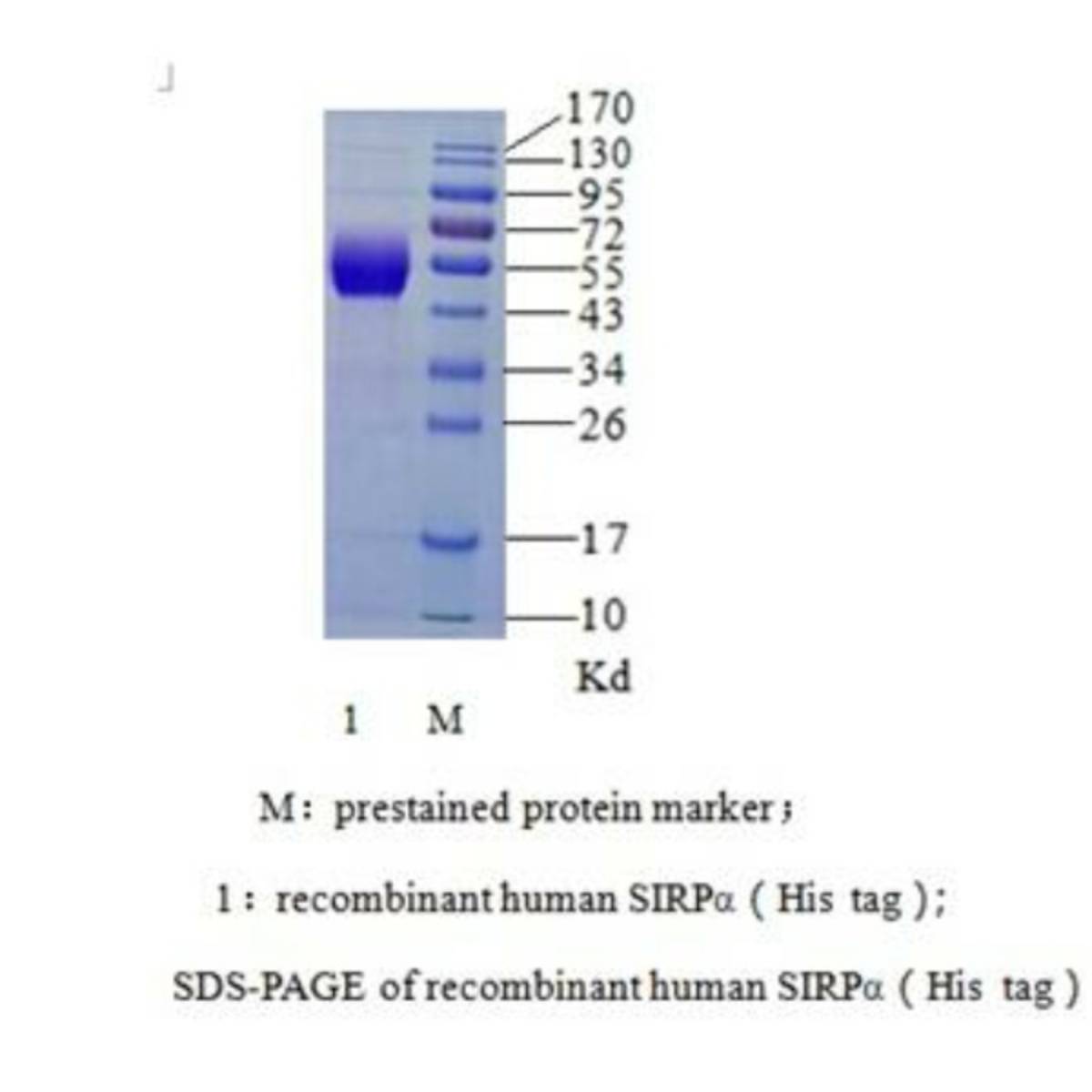 SIRPα (Signal regulatory protein α)
