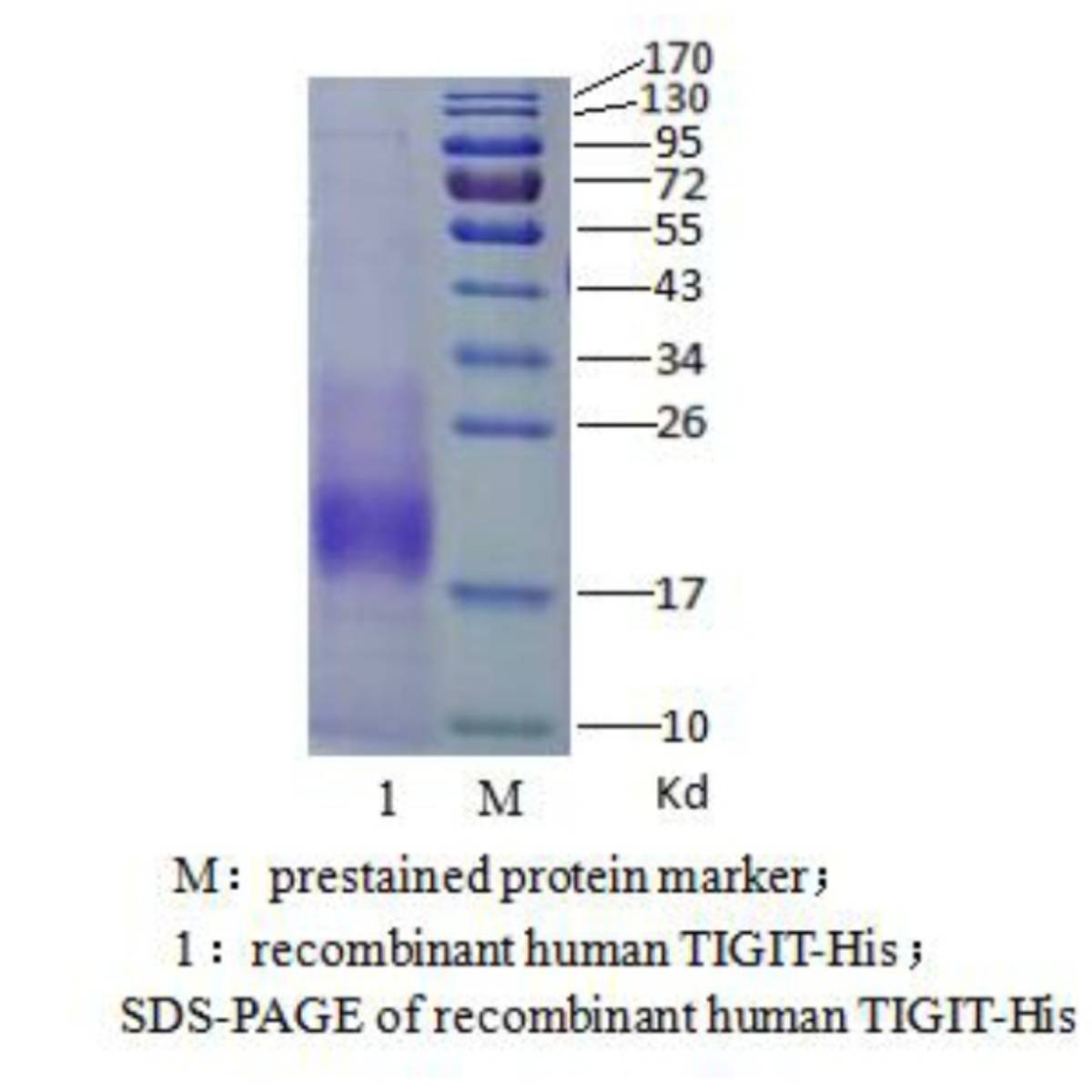 TIGIT(T cell Immunoreceptor with Ig and ITIM domains)