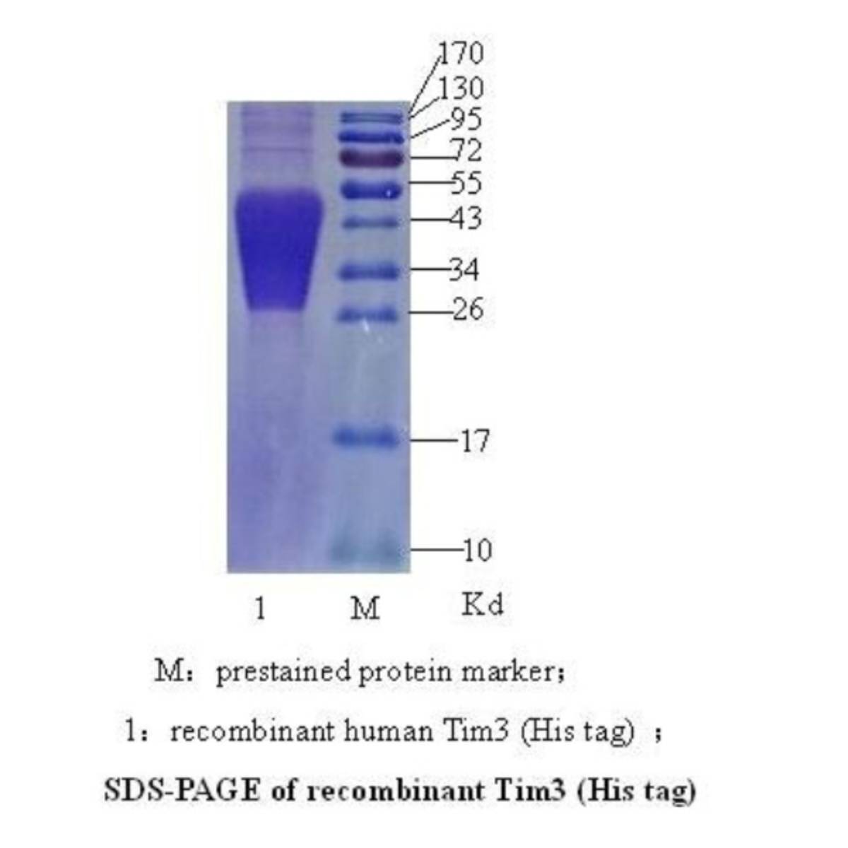 Tim-3(T cell immunoglobulin and mucin domain-3)