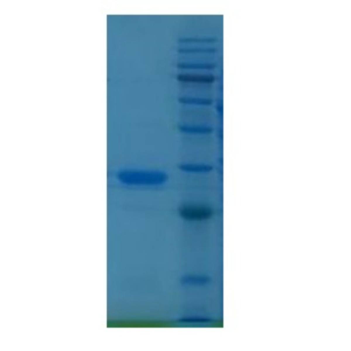 2019-nCoVmainprotease（MPRO）